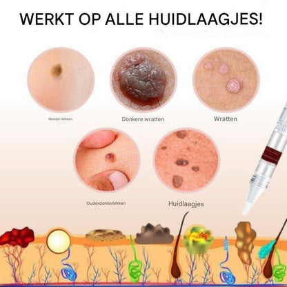 Tags and mole remover