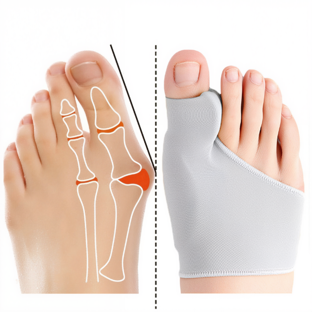 Separador de dedos del pie: corrector del dolor con almohadilla de gel