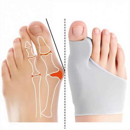 Separador de dedos del pie: corrector del dolor con almohadilla de gel
