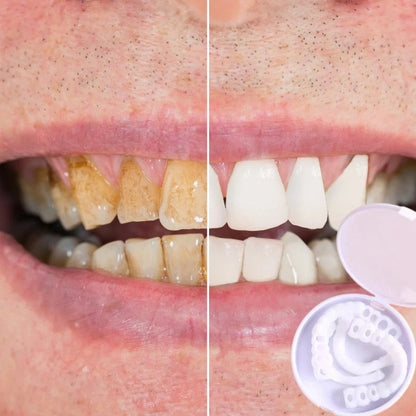 Perfect Smile Set – Radiant and Confident