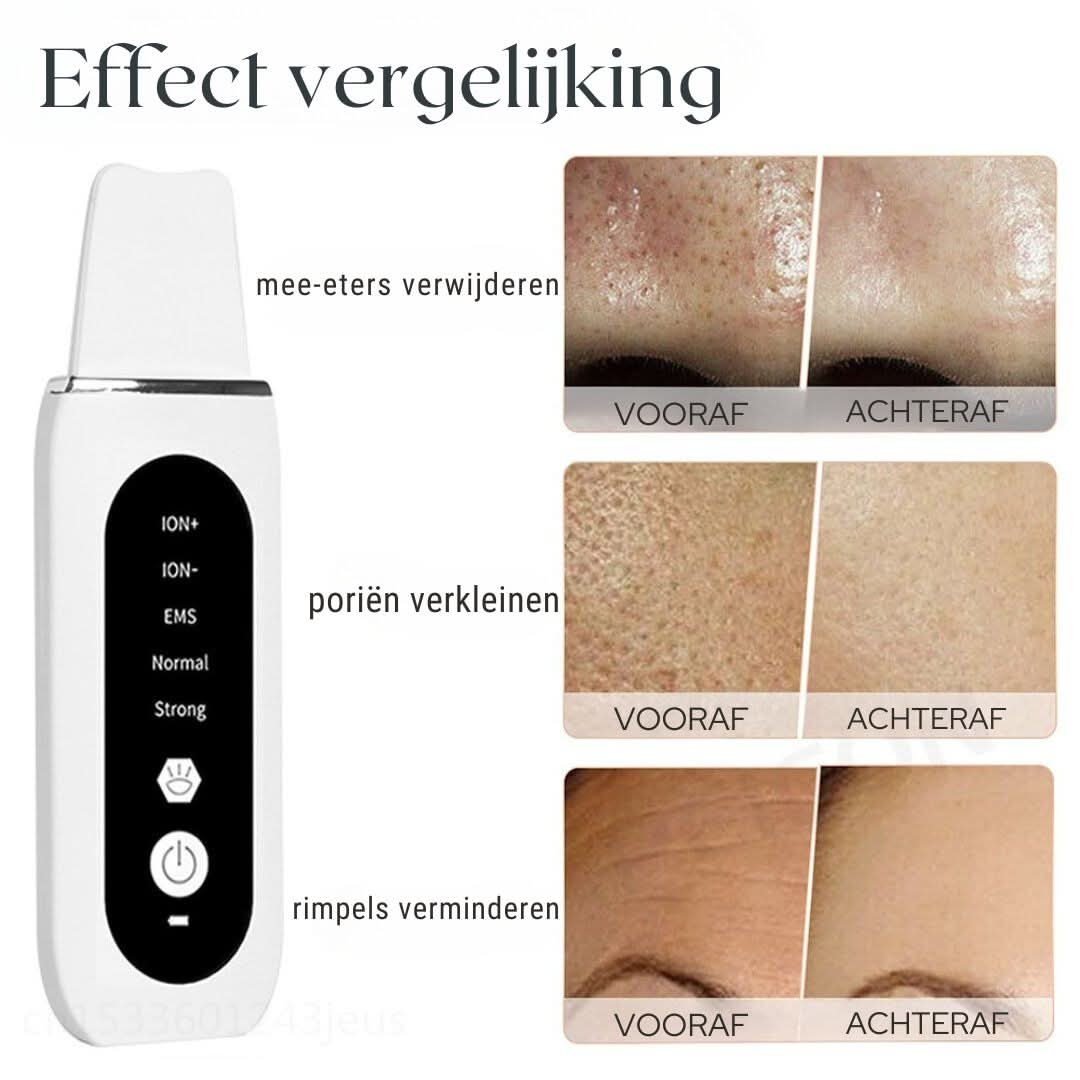Ultraschall-Porenreiniger 5-in-1