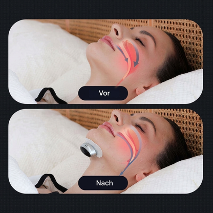 Portable Slim Device Against Snoring