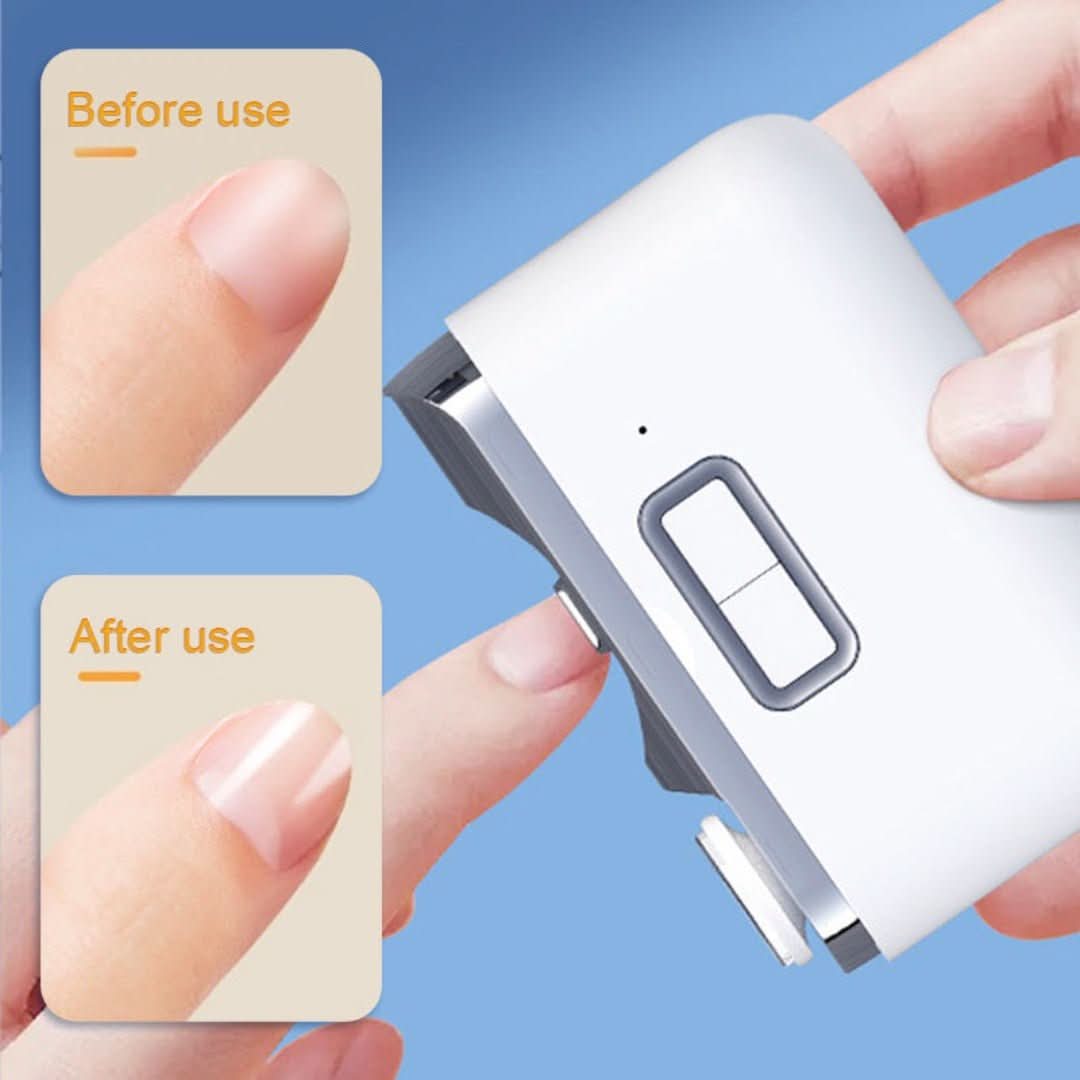 Multi-Nail Clipper | Elektrisch en met variabele snelheid