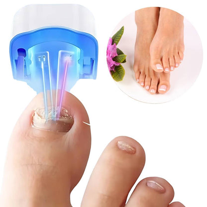 Painless and Effective Laser Treatment for Nail Fungus