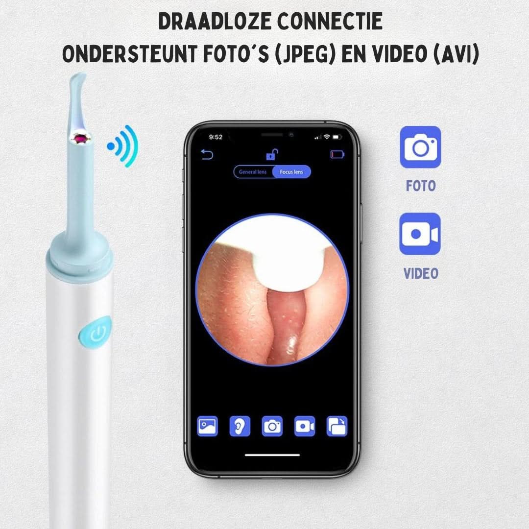 Ear Cleaner | Simple Earwax Removal