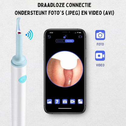 Ear Cleaner | Simple Earwax Removal