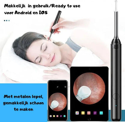 Ear Cleaner | Simple Earwax Removal