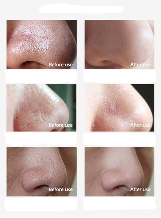 Face Formula - Tiras para eliminar puntos negros en la nariz