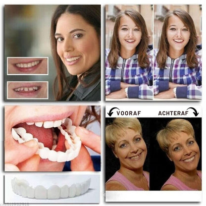 Snap-On Dentures | Adjustable
