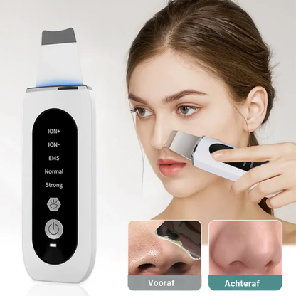 Ultraschall-Porenreiniger 5-in-1
